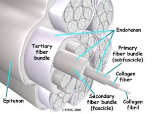 Where does tendonitis develop